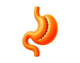 Bariatric & Metabolic Surgery